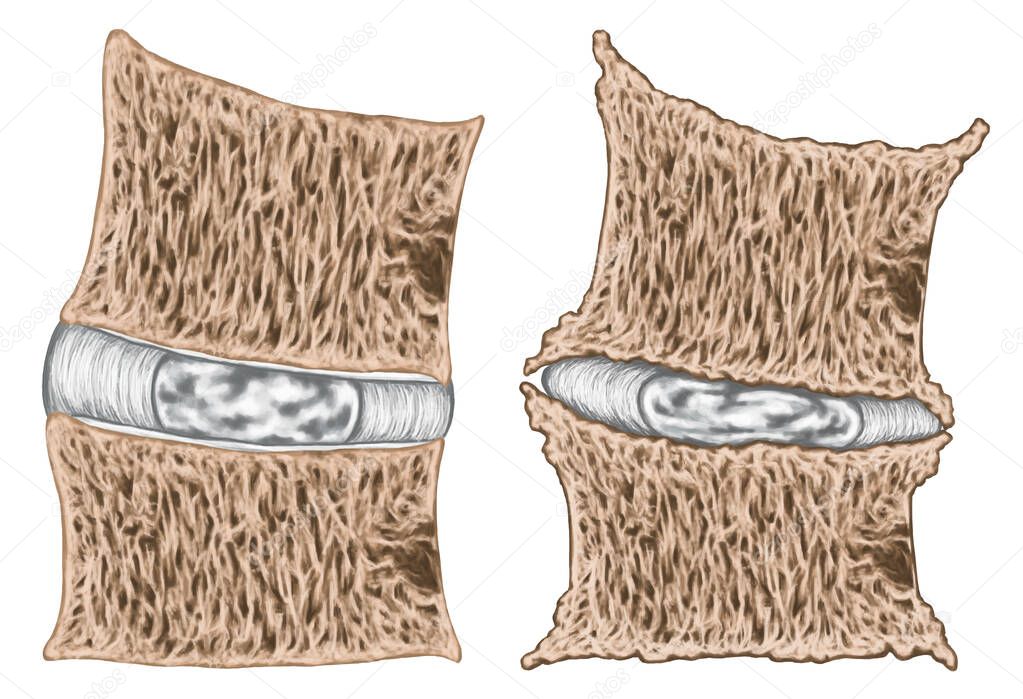 Coronal section through the third and fourth lumbar vertebrae