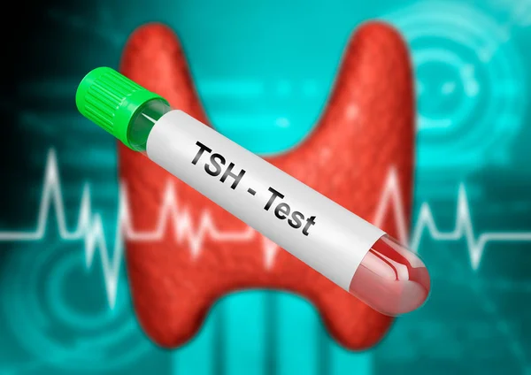 Vzorek Krve Trubice Pro Testování Štítné Žlázy Stimulující Hormon Test — Stock fotografie