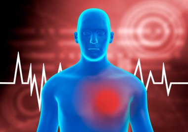 İnsan vücudu mavi hologram. Kalbe oksijen taşıyan atardamarlardaki kan akışının azalmasından kaynaklanan anjin göğüs ağrısı veya darlığı. 3B illüstrasyon