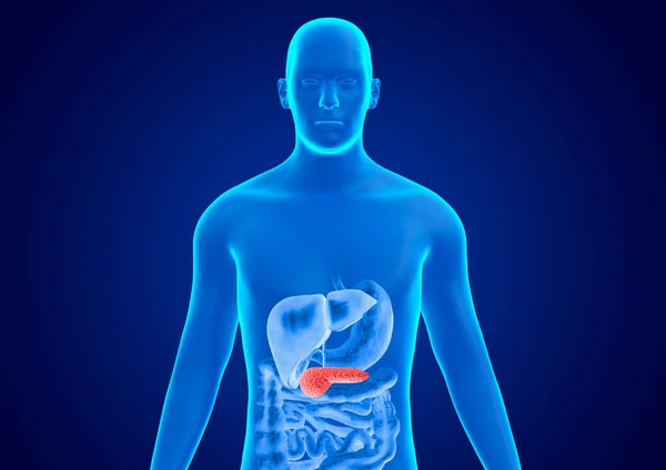 人体蓝色全息图 胰腺炎是胰腺的严重炎症 3D插图 — 图库照片