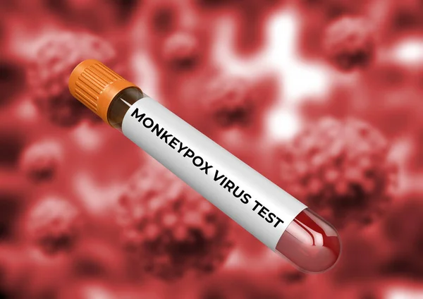 Teste Sangue Para Detectar Infecção Viral Varíola Macróide Transmitida Dos — Fotografia de Stock