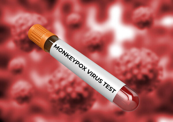 blood test to detect monkeypox viral infection transmitted from animals to humans. 3D illustration