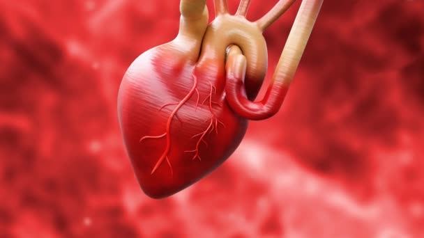 当血块堵塞血液流向心脏时 就会发生心脏病或急性心肌梗死 3D动画 — 图库视频影像