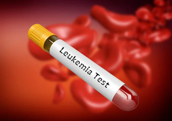 Teste Leucemia Amostra Sangue Tubo Ensaio Ilustração — Fotografia de Stock