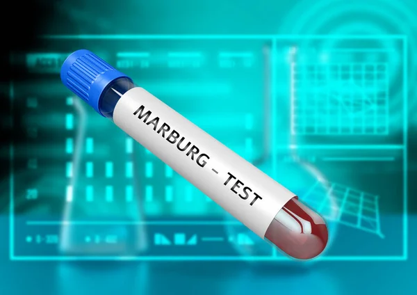 Blood Sample Tube Marburg Virus Marv Highly Infectious Agent Same — Stok fotoğraf