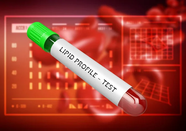 Blood Sample Tube Lipid Profile Testing Test Assess Risk Coronary — Fotografia de Stock
