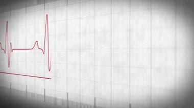 EKG Elektrokardiyogram darbe gerçek
