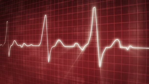 Ekg elektrocardiogram puls trace — Stockvideo