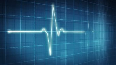EKG Elektrokardiyogram nabız izleme