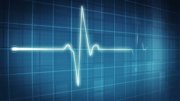 EKG elektrokardiogramu pulzní trasování
