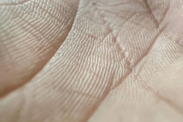 Nahaufnahme Menschliche Hautstruktur Makrohandhautmuster Medizin Und Dermatologie Details Der Kaukasischen — Stockfoto