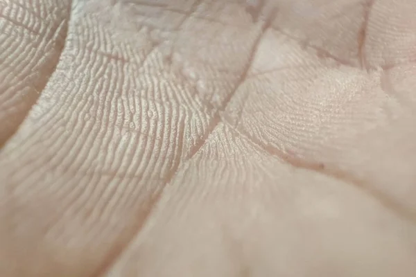Closeup Human Skin Texture Macro Hand Skin Pattern Medicine Dermatology — Stock Photo, Image