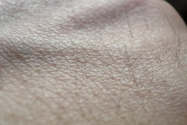 Closeup Textura Pele Humana Padrão Pele Mão Macro Conceito Medicina — Fotografia de Stock