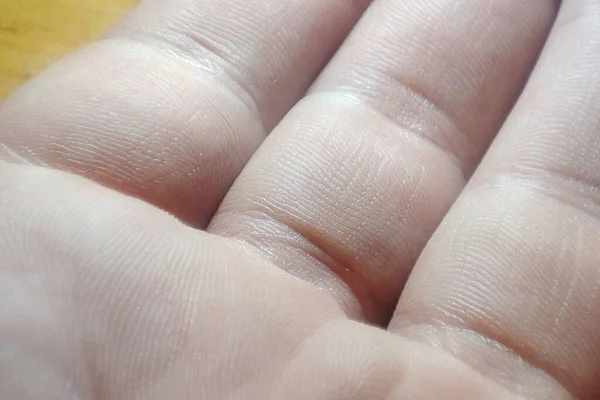 Mão Macro Humana Closeup Textura Pele Branca Medicina Dermatologia Pele — Fotografia de Stock