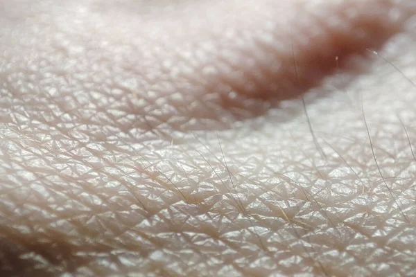 Macro Human Skin Hand Closeup Caucasian Skin Texture Medicine Dermatology — Stock Photo, Image