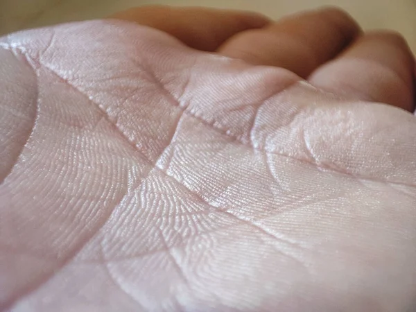 Textura Macro Humana Pele Pele Branca Saudável Conceito Dermatite Detalhe — Fotografia de Stock