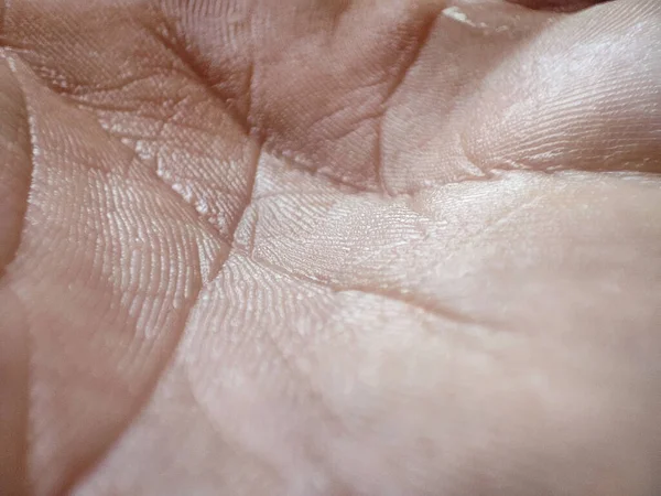 Makro Menschliche Haut Textur Kaukasische Gesunde Haut Dermatitis Konzept Seltsames — Stockfoto