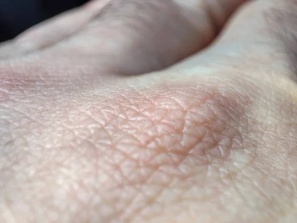 Texture Macro Humaine Peau Peau Personne Dermatologie Fond Peau Santé — Photo