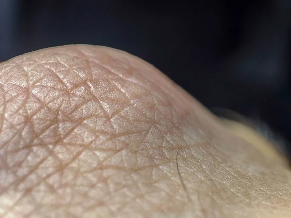 Μακρο Ανθρώπινη Υφή Δέρματος Δέρμα Ανθρώπου Δερματολογικό Υπόβαθρο Δέρμα Υγείας — Φωτογραφία Αρχείου
