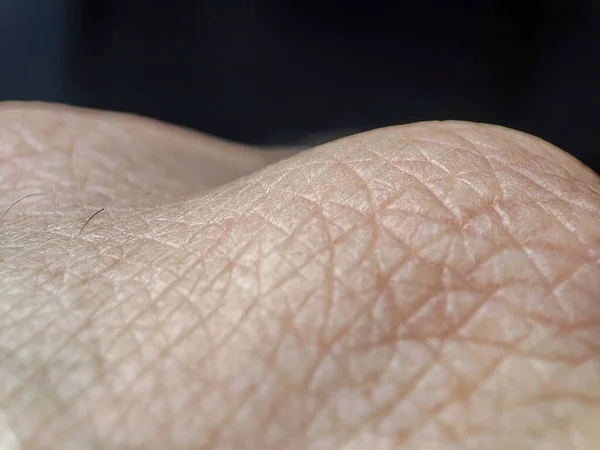 Texture Macro Humaine Peau Peau Personne Dermatologie Fond Peau Santé — Photo
