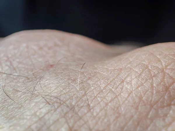 Makro Menschliche Haut Textur Personenhaut Dermatologie Hintergrund Gesundheit Der Haut — Stockfoto