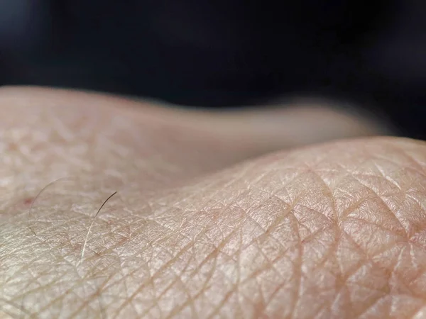 Makro Emberi Bőr Textúra Személybőr Bőrgyógyászati Háttér Egészséges Bőr Kaukázusi — Stock Fotó