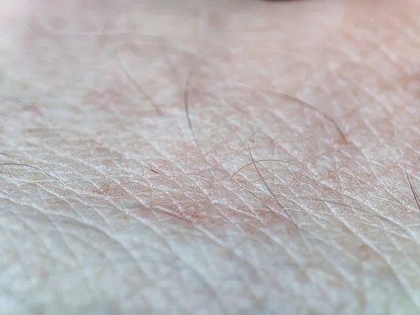 Macro Struttura Della Pelle Umana Pelle Persona Sfondo Dermatologico Pelle — Foto Stock