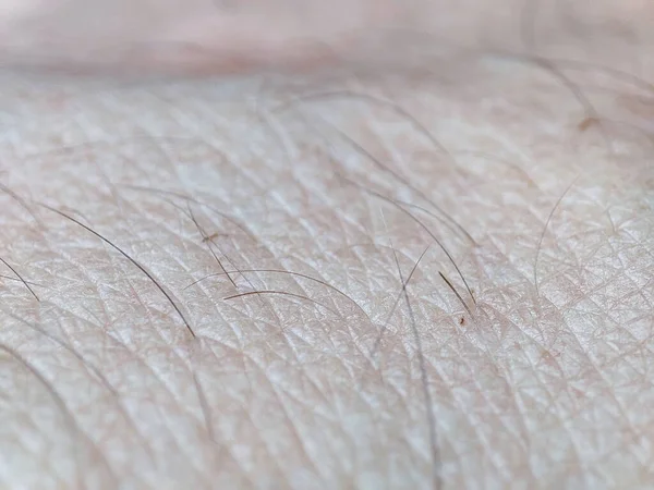 Makro Textura Lidské Kůže Lidská Kůže Kožní Pozadí Zdravá Kůže — Stock fotografie