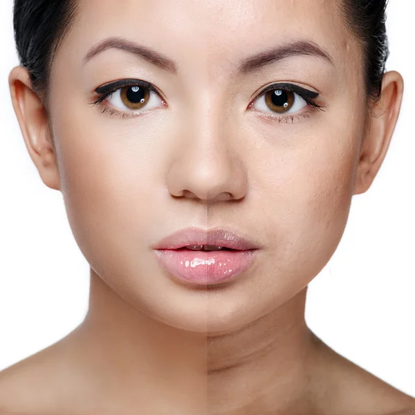 Beautiful healthy versus unhealthy skin complexion — Stock Photo, Image