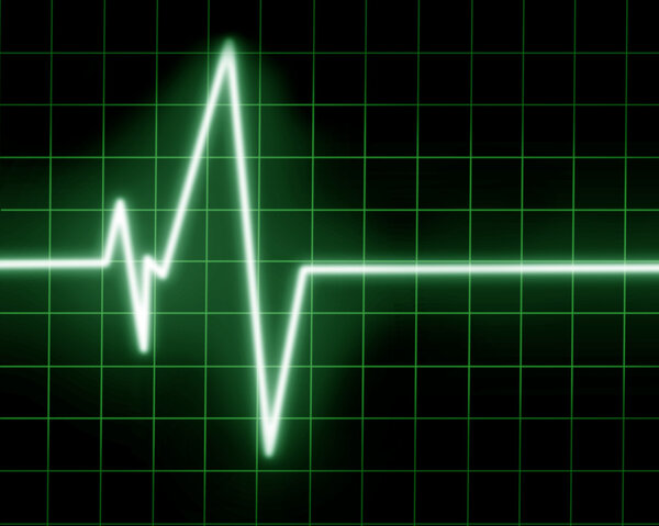 Кардиомонитор
