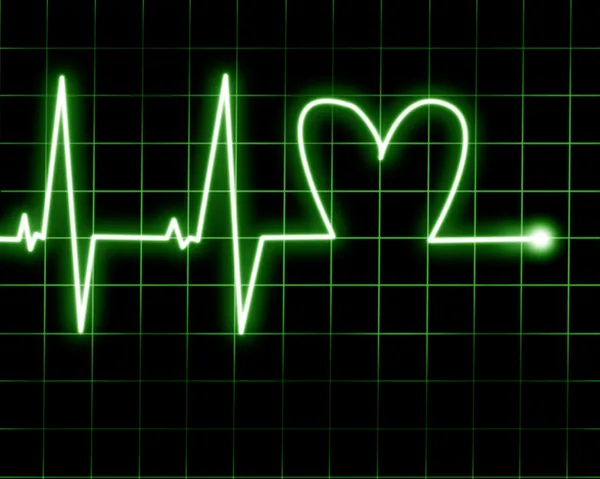 Heart rate — Stock Photo, Image