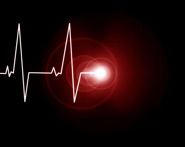 Monitor cardíaco — Fotografia de Stock