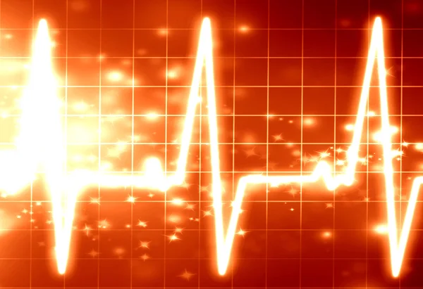 Heartbeat on display — Stock Photo, Image