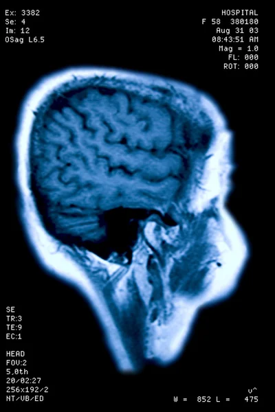 E.T. magnetic resonance — Stock Photo, Image