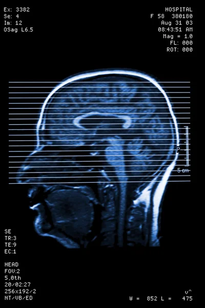 Head resonance — Stock Photo, Image