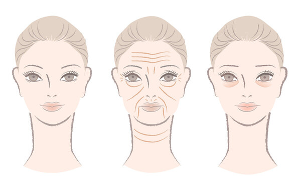 Beautiful woman getting wrinkles, under-eye bags as she ages