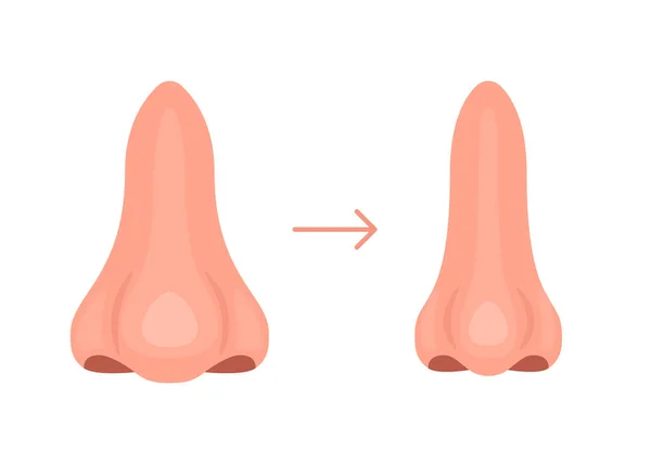 Nosorožče Změň Nos Před Plastické Operaci Nosu Korekce Vzhledu Kosmetickém — Stockový vektor