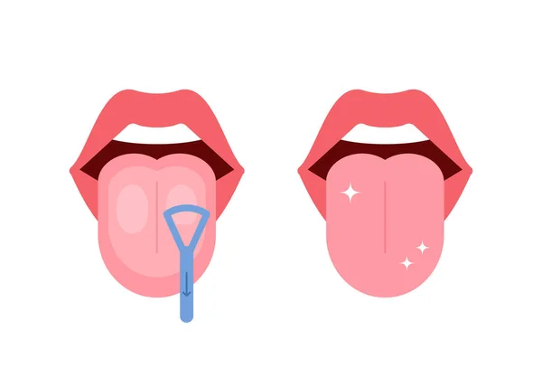 Limpiar la lengua limpiador de garganta raspador en la boca. Antes y después de limpiar la lengua. Prevención de la halitosis. Ilustración vectorial — Vector de stock