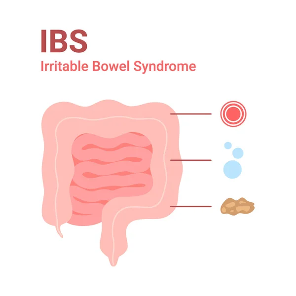 Irriterbart tarmsyndrom, IBS. Symtom vid tarm smärta, uppblåsthet och diarré. Vektorillustration — Stock vektor