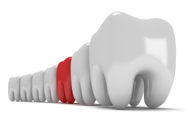 sağlıklı dişler satırındaki ağrıyan diş