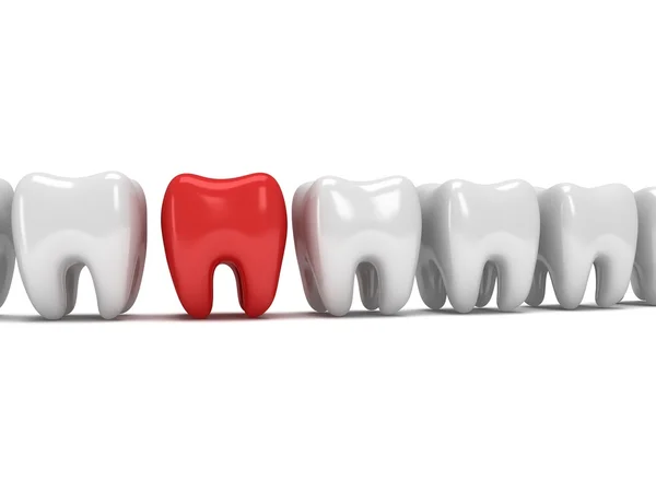 Schmerzende Zähne in einer Reihe gesunder Zähne — Stockfoto
