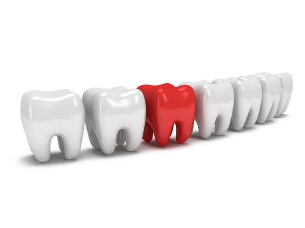 Aching tooth in row of healthy teeth — Stock Photo, Image