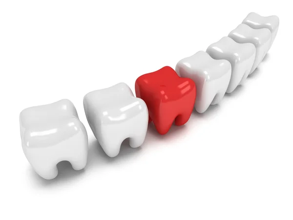 Pijnlijke tand in rij van gezonde tanden — Stockfoto