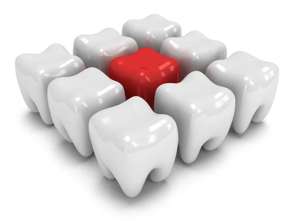 Värkande tand i rad i friska tänder — Stockfoto