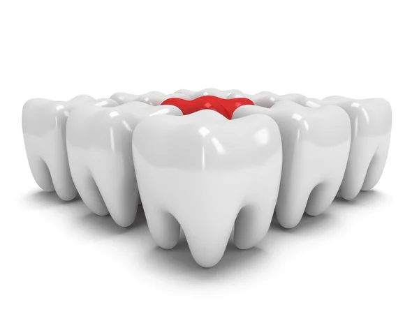 Aching tooth in row of healthy teeth — Stock Photo, Image