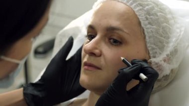Beautician preparing woman's face for needle therapy treatment. Close-up. Slow motion.