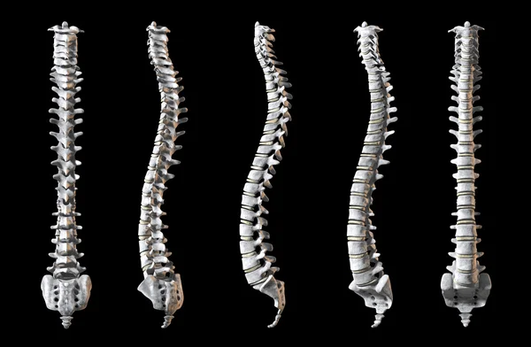 Embalagem da coluna vertebral humana — Fotografia de Stock