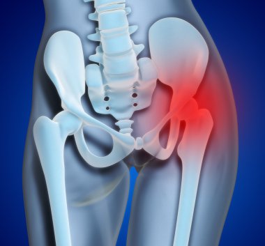 Knee Pain clipart