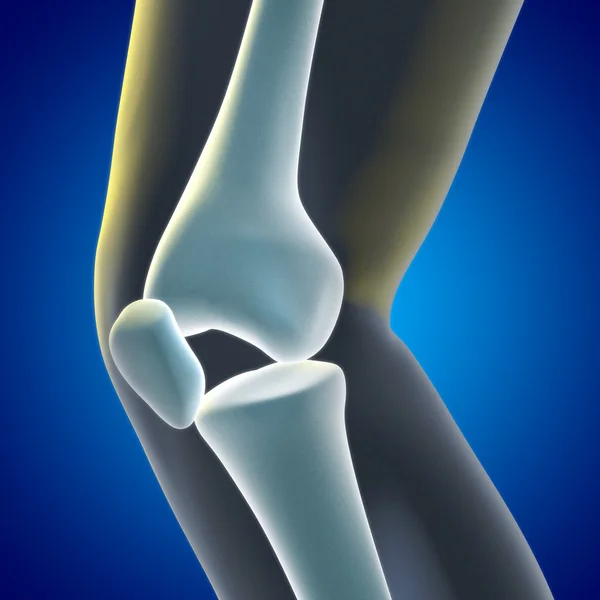 Radiografia del ginocchio — Foto Stock