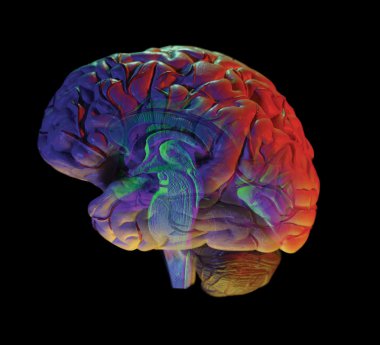 Siyah Brain